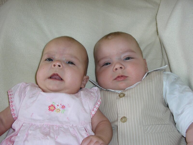 The Strange Case of the Pollock Twins: Reincarnation or Coincidence? The Strange Case of the Pollock Twins: Reincarnation or Coincidence?