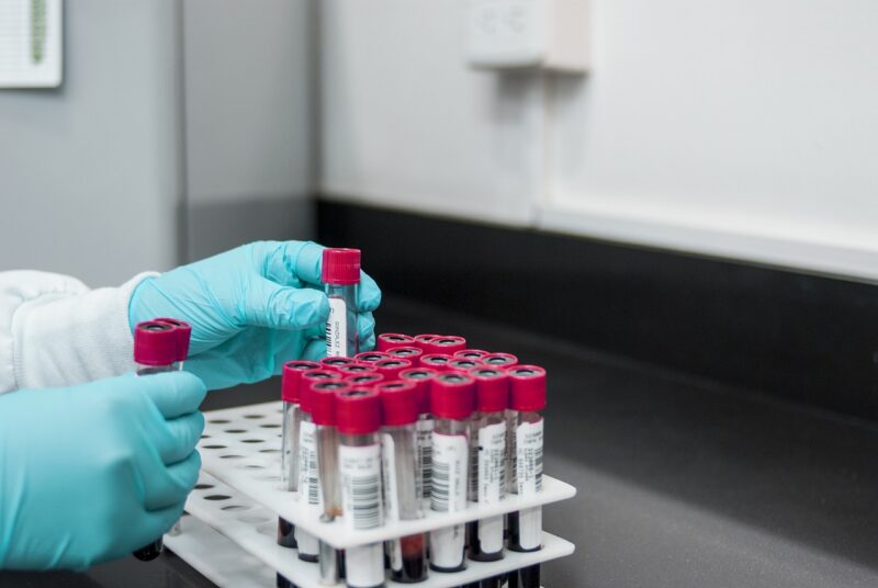 Theories Surrounding the ‘Lost’ Lab Experiments That Changed Our World Theories Surrounding the ‘Lost’ Lab Experiments That Changed Our World